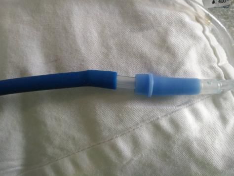 氧气连接管怎么使用紧急患者外出检查，氧气袋巧妙连接快速高效_https://www.jmylbn.com_新闻资讯_第4张