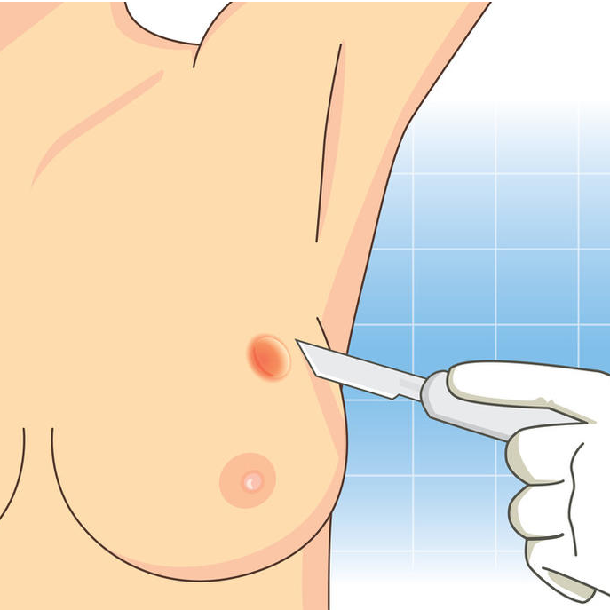 乳腺数字片又叫什么2级、3级、4级…这些常出现在乳腺检查的数字，到底代表什么？_https://www.jmylbn.com_新闻资讯_第13张