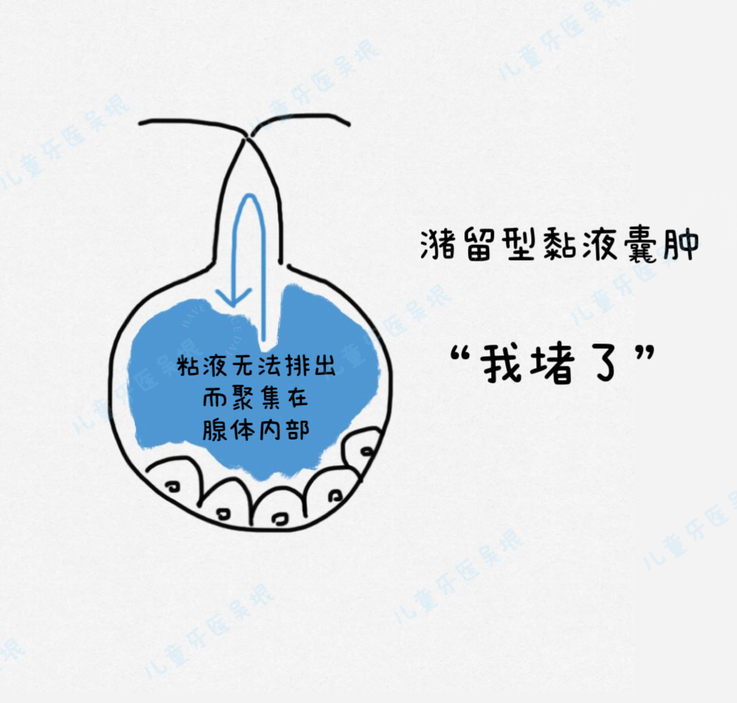 口腔长泡是什么原因引起的