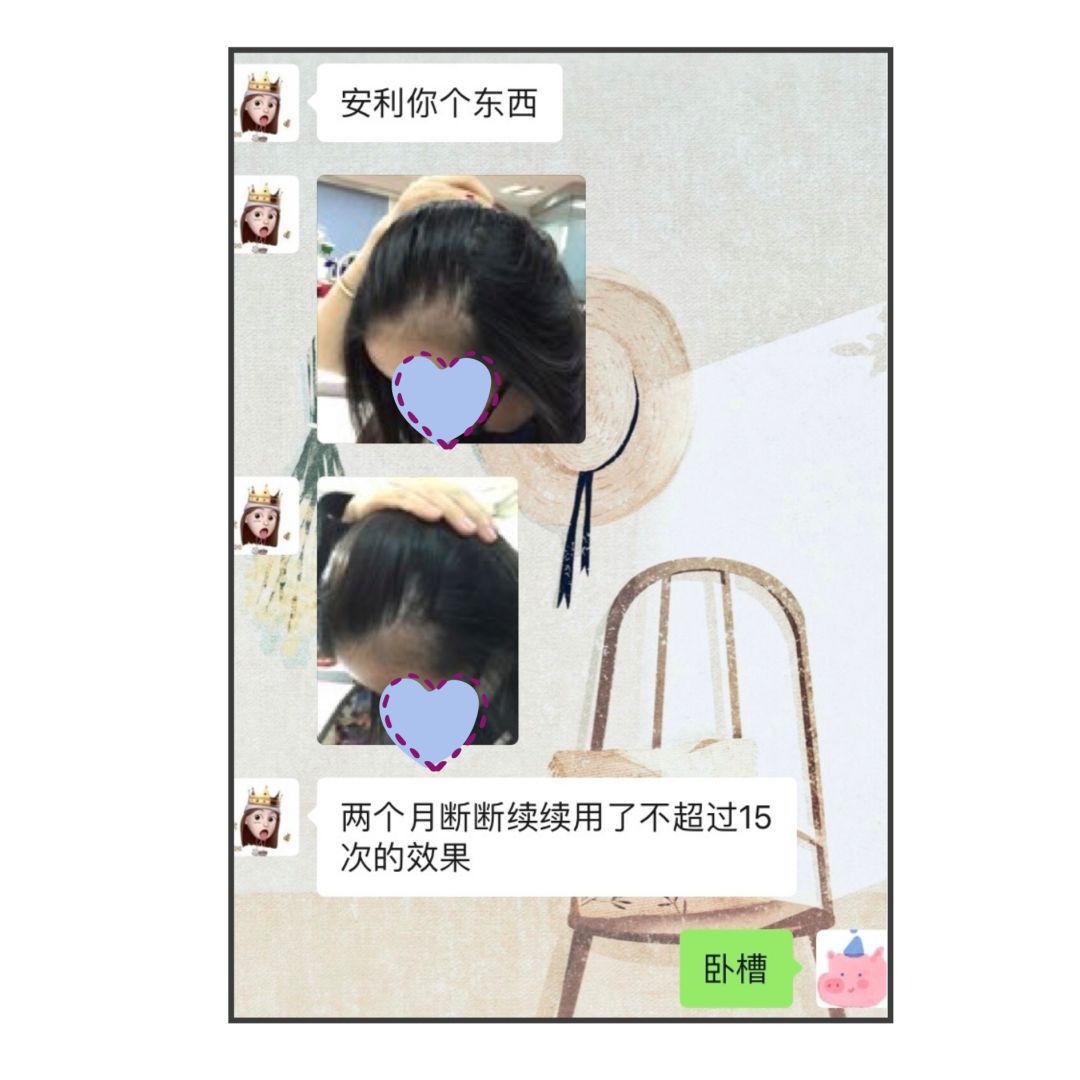 拯救发际线有多难？这份硬核防脱发指南了解一下！