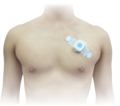 六导心电图怎么用单导联长程动态心电图的临床应用价值（十六）——麻醉科_https://www.jmylbn.com_新闻资讯_第8张