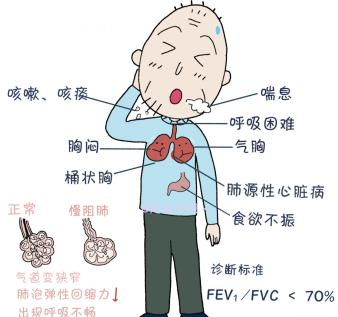 为什么到了夏天慢阻肺更厉害【健康科普】“冬病夏治”——助慢阻肺患者呼吸更轻松_https://www.jmylbn.com_新闻资讯_第9张