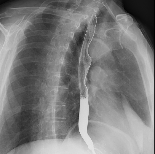 数字胃肠透视怎么做【三级医院创建 • 技术装备提升】数字胃肠检查，让胃肠疾病无处隐藏——我院引进多功能数字透视摄影系统_https://www.jmylbn.com_新闻资讯_第8张