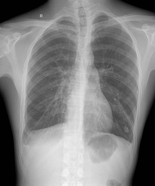 数字胃肠透视怎么做【三级医院创建 • 技术装备提升】数字胃肠检查，让胃肠疾病无处隐藏——我院引进多功能数字透视摄影系统_https://www.jmylbn.com_新闻资讯_第16张