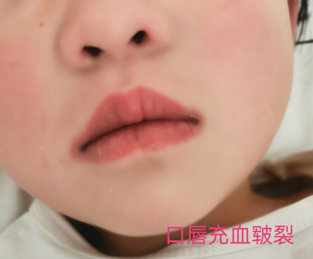 洗胃去什么科学科巡礼 ｜ 第五期 • 西乡县人民医院儿一科：清澈的爱 只为儿童健康成长_https://www.jmylbn.com_新闻资讯_第46张