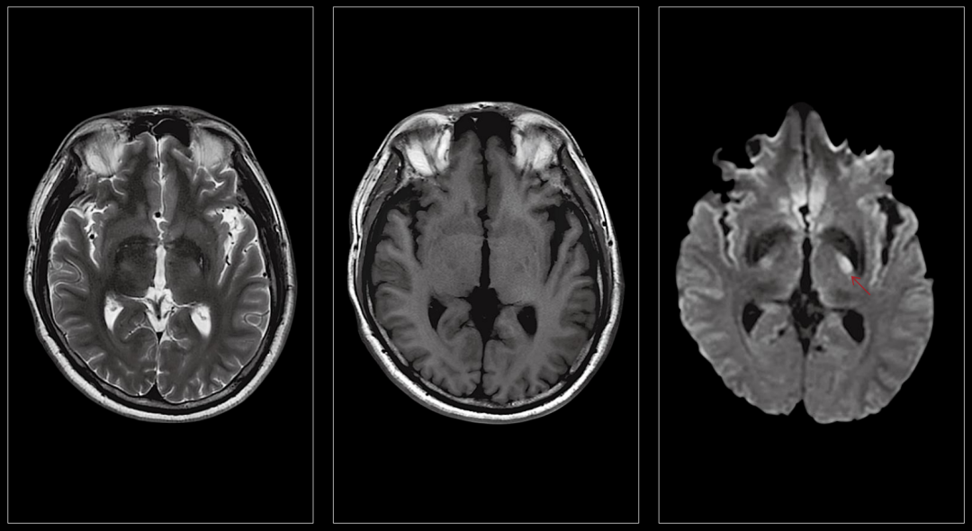 联影磁共振怎么样【三级医院创建 • 技术装备提升】再添医学影像“利器”——我院引进联影uMR870  3.0T磁共振_https://www.jmylbn.com_新闻资讯_第16张