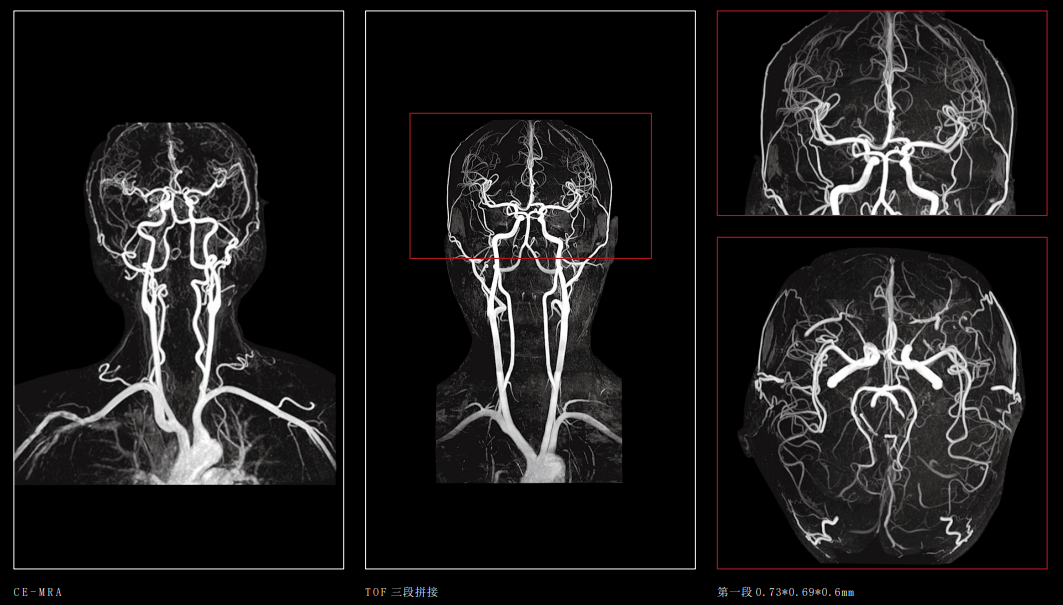 联影磁共振怎么样【三级医院创建 • 技术装备提升】再添医学影像“利器”——我院引进联影uMR870  3.0T磁共振_https://www.jmylbn.com_新闻资讯_第17张