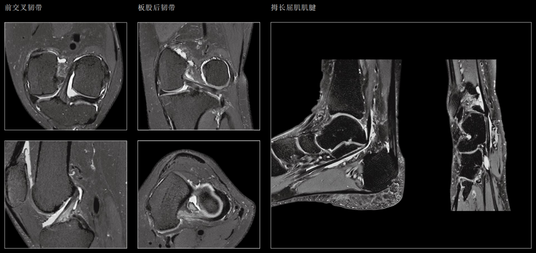 联影磁共振怎么样【三级医院创建 • 技术装备提升】再添医学影像“利器”——我院引进联影uMR870  3.0T磁共振_https://www.jmylbn.com_新闻资讯_第23张