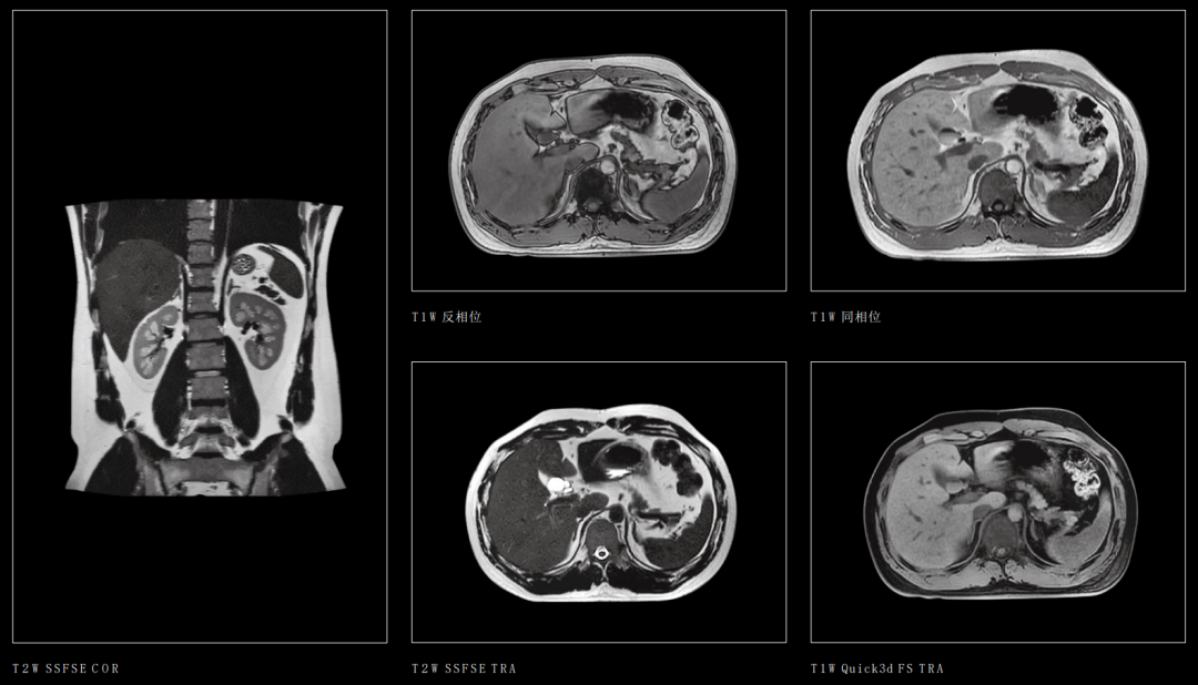 联影磁共振怎么样【三级医院创建 • 技术装备提升】再添医学影像“利器”——我院引进联影uMR870  3.0T磁共振_https://www.jmylbn.com_新闻资讯_第25张