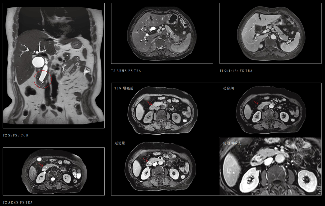 联影磁共振怎么样【三级医院创建 • 技术装备提升】再添医学影像“利器”——我院引进联影uMR870  3.0T磁共振_https://www.jmylbn.com_新闻资讯_第20张