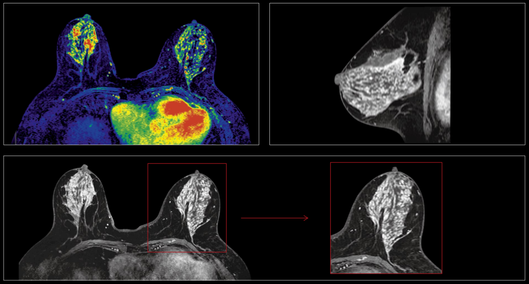 联影磁共振怎么样【三级医院创建 • 技术装备提升】再添医学影像“利器”——我院引进联影uMR870  3.0T磁共振_https://www.jmylbn.com_新闻资讯_第26张