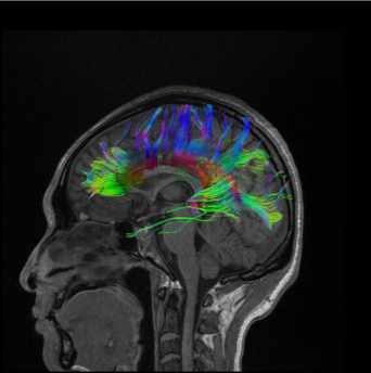 医用ct胶片怎么收纳医用彩色胶片：让影像诊断更精准的“全彩视界”_https://www.jmylbn.com_新闻资讯_第4张