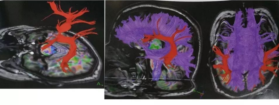 医用ct胶片怎么收纳医用彩色胶片：让影像诊断更精准的“全彩视界”_https://www.jmylbn.com_新闻资讯_第5张