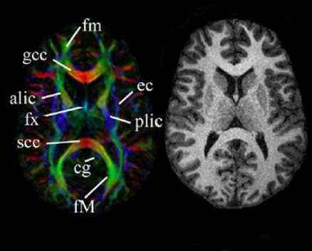 医用ct胶片怎么收纳医用彩色胶片：让影像诊断更精准的“全彩视界”_https://www.jmylbn.com_新闻资讯_第2张