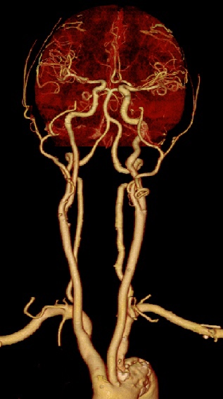 医用ct胶片怎么收纳医用彩色胶片：让影像诊断更精准的“全彩视界”_https://www.jmylbn.com_新闻资讯_第8张