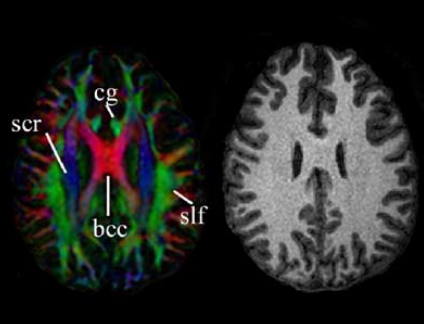 医用ct胶片怎么收纳医用彩色胶片：让影像诊断更精准的“全彩视界”_https://www.jmylbn.com_新闻资讯_第3张
