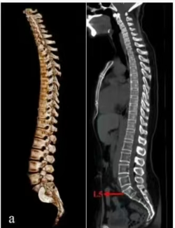 医用ct胶片怎么收纳医用彩色胶片：让影像诊断更精准的“全彩视界”_https://www.jmylbn.com_新闻资讯_第7张