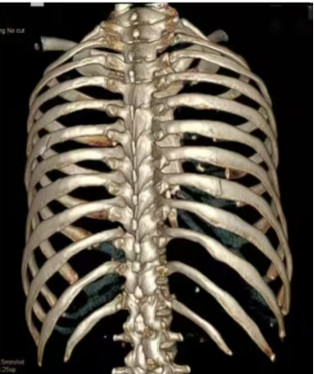 医用ct胶片怎么收纳医用彩色胶片：让影像诊断更精准的“全彩视界”_https://www.jmylbn.com_新闻资讯_第6张