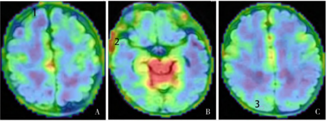 医用ct胶片怎么收纳医用彩色胶片：让影像诊断更精准的“全彩视界”_https://www.jmylbn.com_新闻资讯_第10张