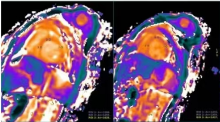 医用ct胶片怎么收纳医用彩色胶片：让影像诊断更精准的“全彩视界”_https://www.jmylbn.com_新闻资讯_第11张