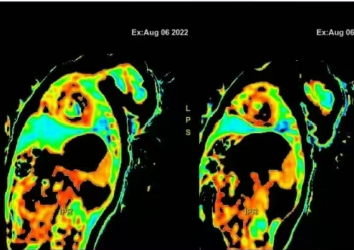 医用ct胶片怎么收纳医用彩色胶片：让影像诊断更精准的“全彩视界”_https://www.jmylbn.com_新闻资讯_第12张