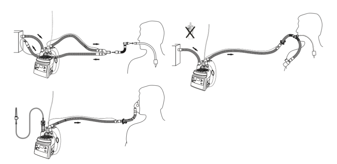 850湿化器怎么调呼吸湿化器：冷凝水的管理细节_https://www.jmylbn.com_新闻资讯_第6张