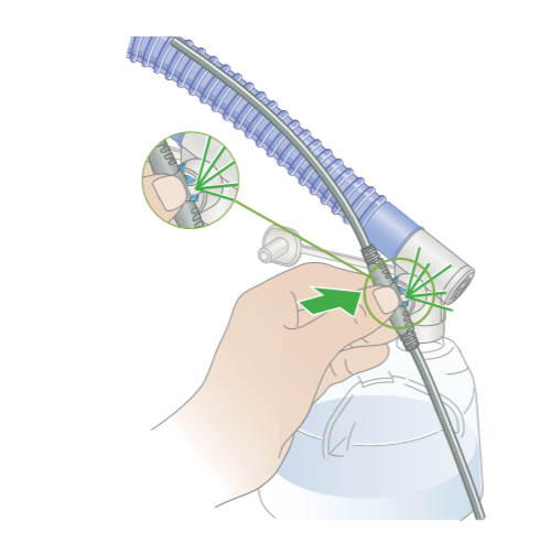 850湿化器怎么调呼吸湿化器：冷凝水的管理细节_https://www.jmylbn.com_新闻资讯_第8张