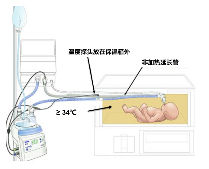 850湿化器怎么调呼吸湿化器：冷凝水的管理细节_https://www.jmylbn.com_新闻资讯_第12张