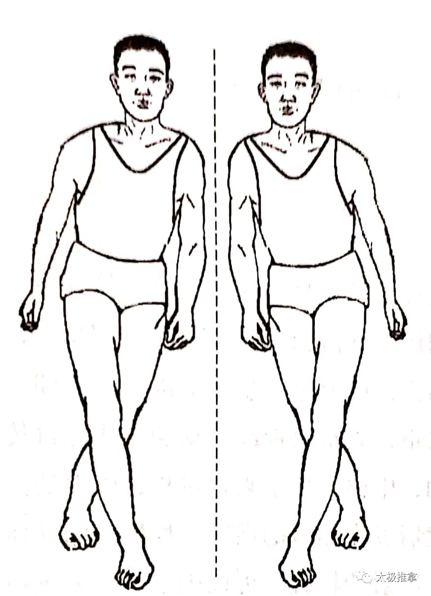步态分析上曲线怎么解读常见异常步态分析_https://www.jmylbn.com_新闻资讯_第15张