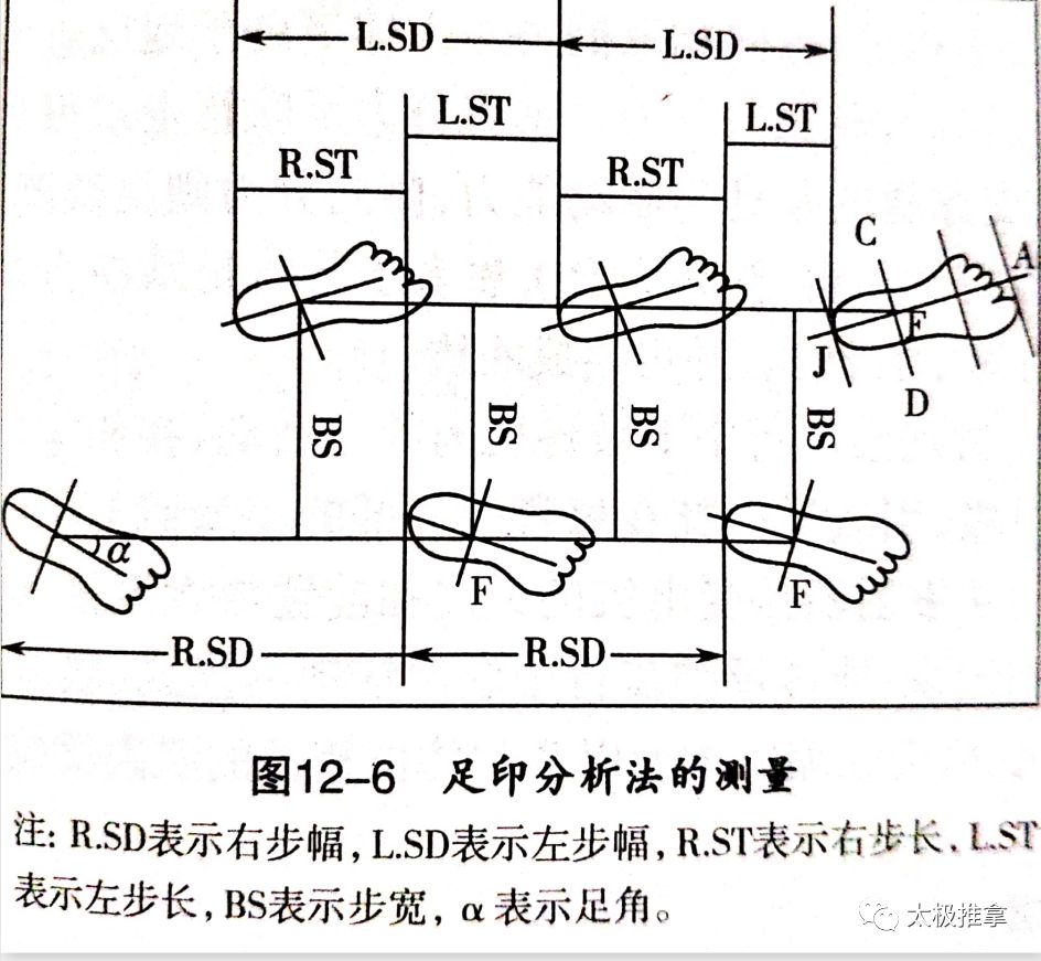 步态分析上曲线怎么解读常见异常步态分析_https://www.jmylbn.com_新闻资讯_第2张
