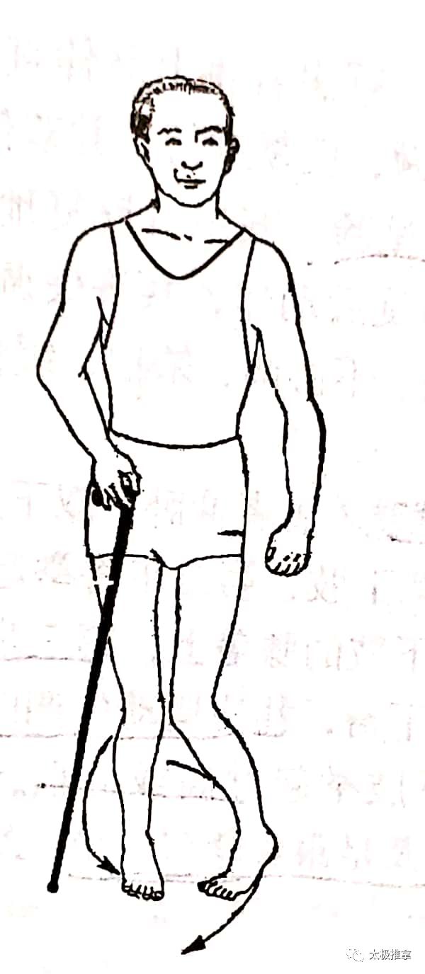 步态分析上曲线怎么解读常见异常步态分析_https://www.jmylbn.com_新闻资讯_第13张