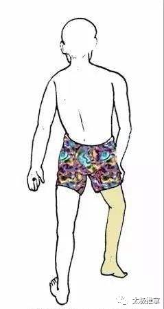 步态分析上曲线怎么解读常见异常步态分析_https://www.jmylbn.com_新闻资讯_第10张