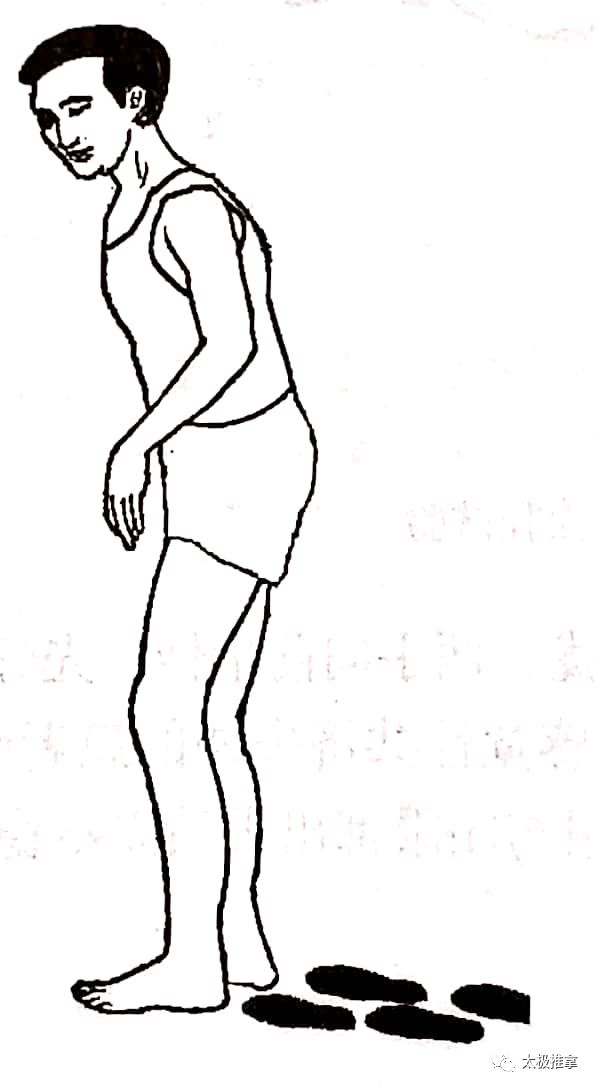 步态分析上曲线怎么解读常见异常步态分析_https://www.jmylbn.com_新闻资讯_第14张