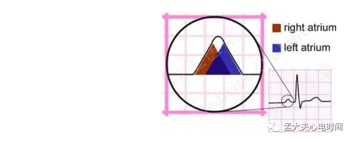p心电图功能怎么开通心电基础-P波_https://www.jmylbn.com_新闻资讯_第3张