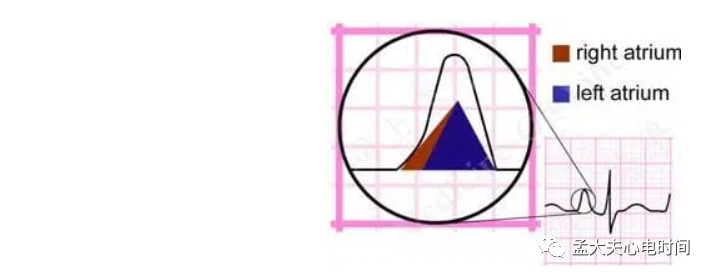 p心电图功能怎么开通心电基础-P波_https://www.jmylbn.com_新闻资讯_第4张
