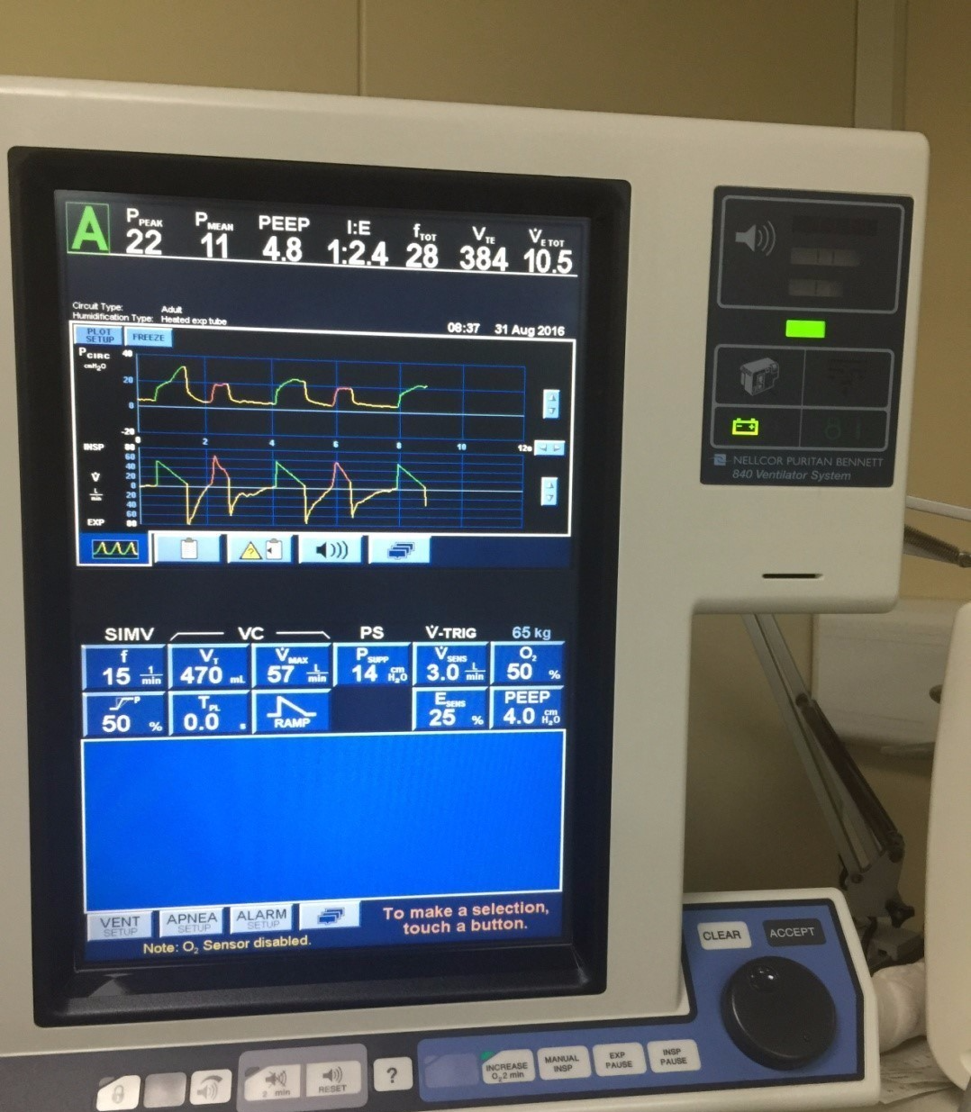 呼吸机是怎么用的呼吸机的常用模式和使用_https://www.jmylbn.com_新闻资讯_第12张