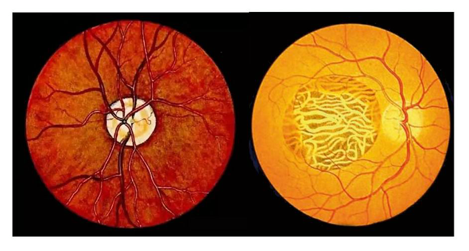 检眼镜怎么看眼底是怎么看见的——Helmholtz发明检眼镜的故事_https://www.jmylbn.com_新闻资讯_第5张