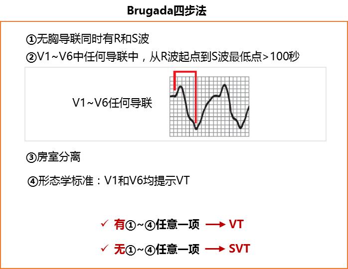 室速与室上速的快速鉴别方法