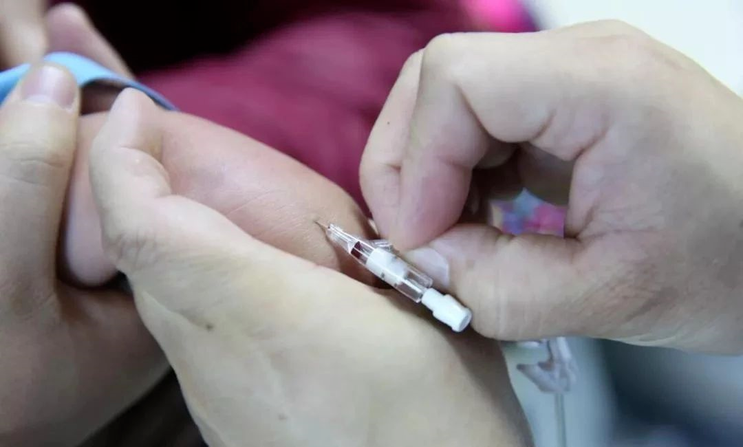 留置针怎么单手推针单手退针，学会你就无敌了！_https://www.jmylbn.com_新闻资讯_第4张