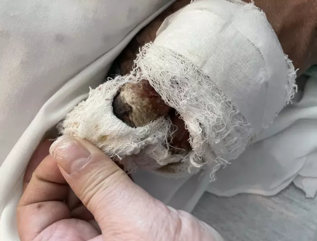 餐馆要客人戴口罩，深夜却遭报复，店面被喷“滚回中国”油漆！54岁华男被“打瘫”，恐“截手指”（组图） - 10