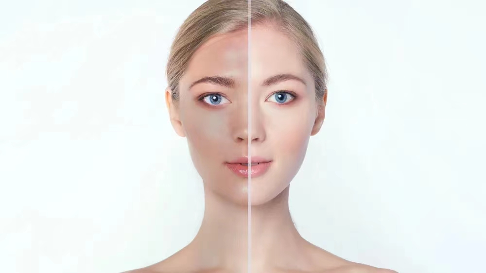 光子治疗仪有什么作用【皮肤科再添治疗神器】光子嫩肤治疗仪和红蓝光治疗仪进驻我院_https://www.jmylbn.com_新闻资讯_第11张