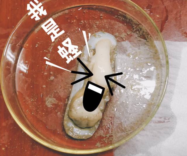 台州有人在蛏子里吃出寄生虫真相是