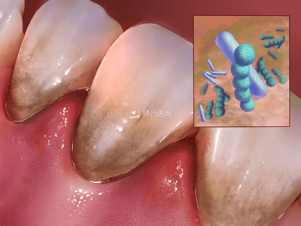 怎么选洁牙器械洗牙到底有好处还是坏处？牙医告诉你真相_https://www.jmylbn.com_新闻资讯_第1张