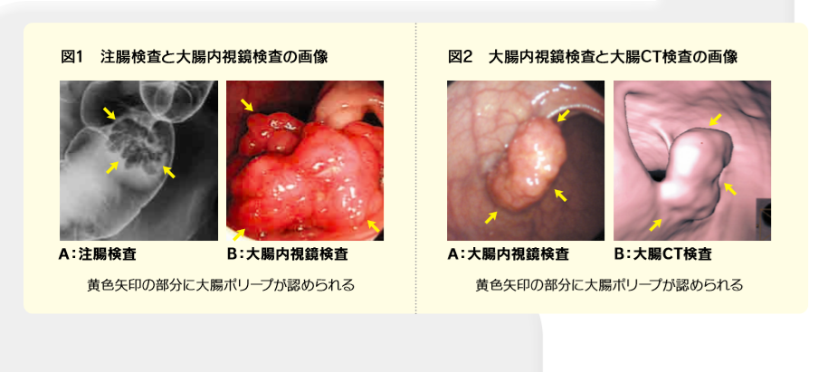 让安倍辞职的这个病 年轻人高发 有这情况建议检查 南方日报微信公众号文章