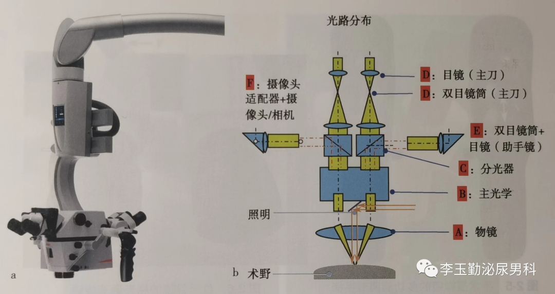 什么是显微镜手术如何使用显微镜做手术？_https://www.jmylbn.com_新闻资讯_第3张