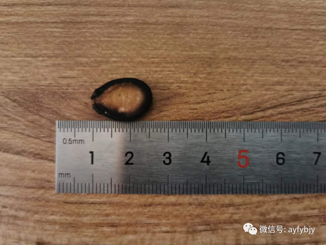 活检MM什么【一根细针辨良恶】一例超声引导下5mm×4mm甲状腺癌细针穿刺活检个案报道_https://www.jmylbn.com_新闻资讯_第6张