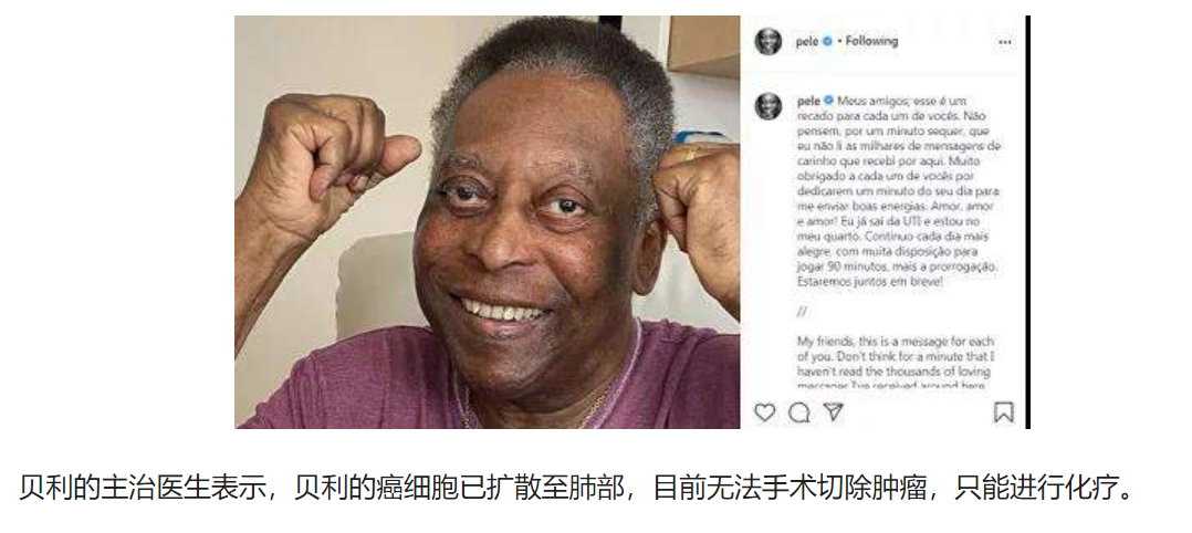 球王贝利因结肠癌复发医治无效去世