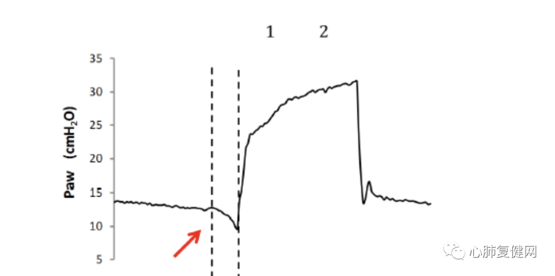 为什么呼吸机人机同步如何提高患者与呼吸机的同步性——第一部分_https://www.jmylbn.com_新闻资讯_第1张