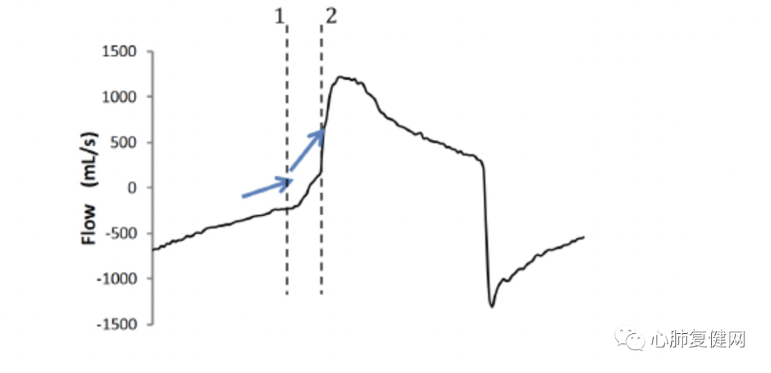为什么呼吸机人机同步如何提高患者与呼吸机的同步性——第一部分_https://www.jmylbn.com_新闻资讯_第2张