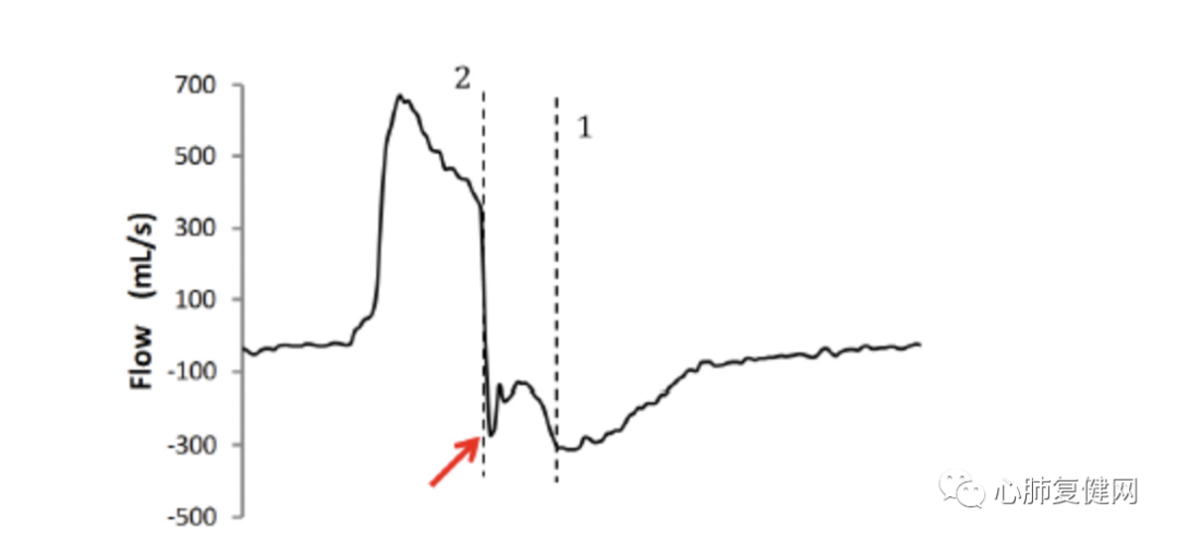 为什么呼吸机人机同步如何提高患者与呼吸机的同步性——第一部分_https://www.jmylbn.com_新闻资讯_第5张